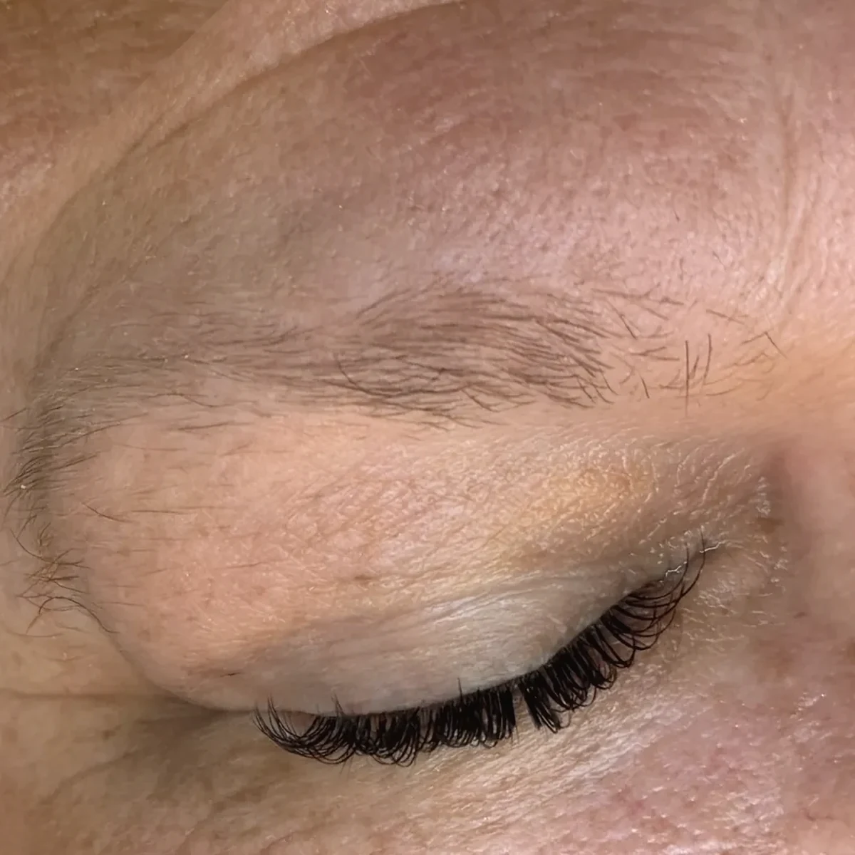 Vorher: natürliche, ungeformte Augenbraue vor dem Browlifting