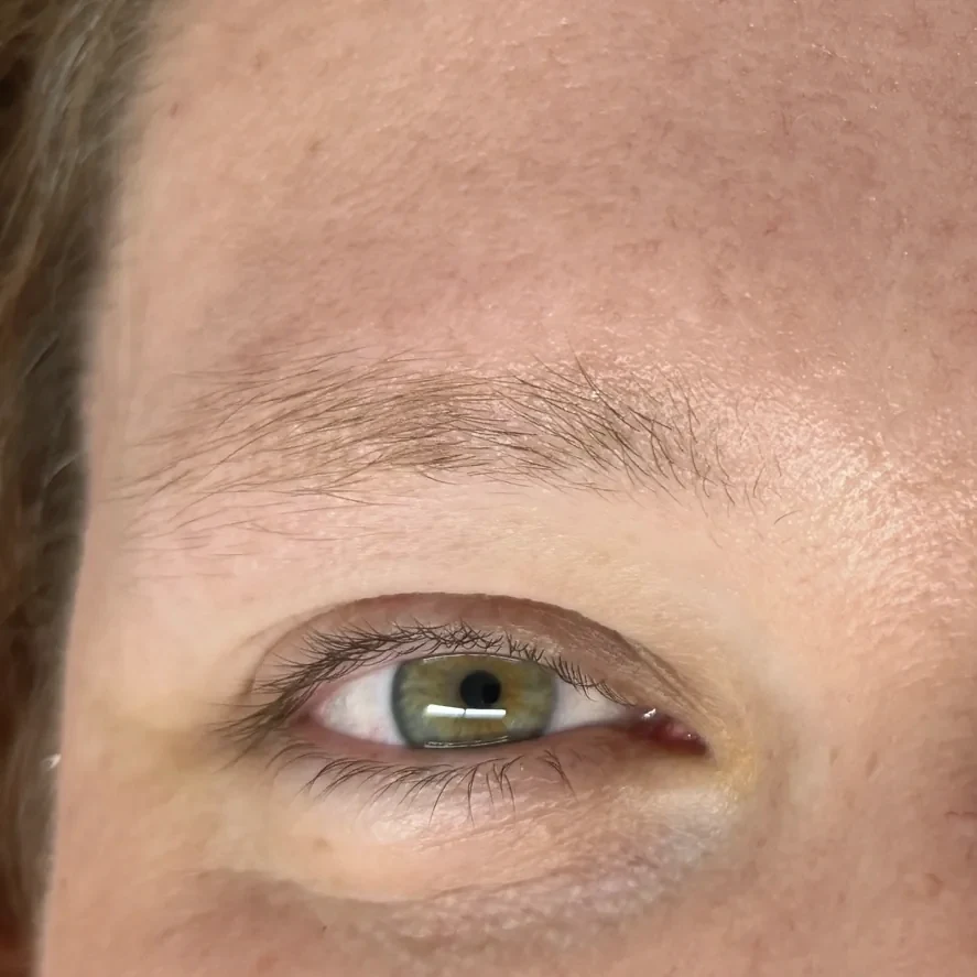 Augenbraue und Wimpern vor dem Perfect Eye Package