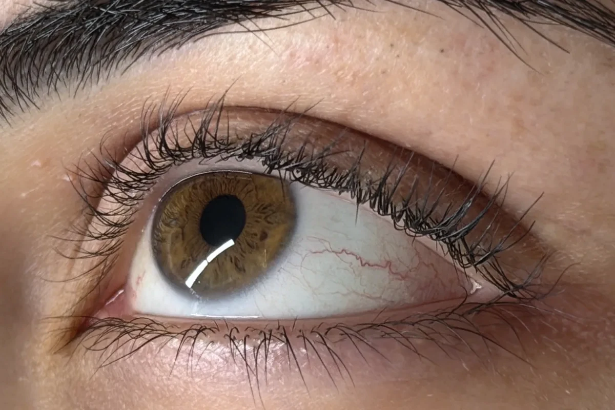 Vorher: ungleichmäßig geformte Wimpern nach einem Lifting in einem anderen Studio